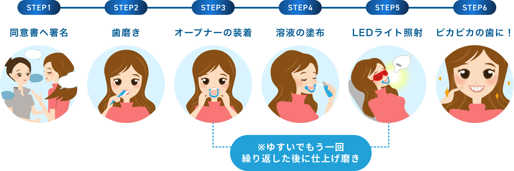 シャリオンのホワイトニングをお客様が利用する手順の解説図
